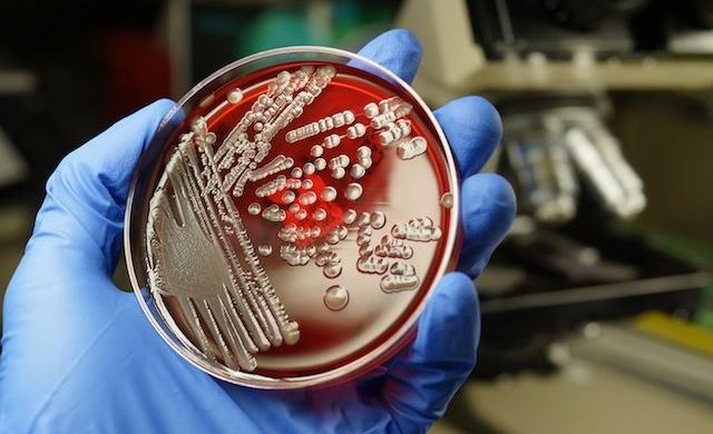 Britské farmafirmy se složí na výzkum antibiotik a Pfizer kupuje Anacor